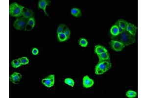Immunofluorescent analysis of A431 cells using ABIN7153331 at dilution of 1:100 and Alexa Fluor 488-congugated AffiniPure Goat Anti-Rabbit IgG(H+L) (GPR176 antibody  (AA 321-515))