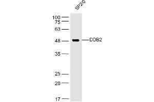 SP2/0 lysates probed with DDB2 Polyclonal Antibody, Unconjugated  at 1:500 dilution and 4˚C overnight incubation. (DDB2 antibody  (AA 201-300))