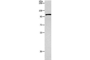 Western Blot analysis of 231 cell using TNK2 Polyclonal Antibody at dilution of 1:1800 (TNK2 antibody)