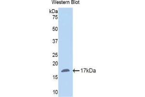 Western blot analysis of the recombinant protein. (NNMT antibody  (AA 127-249))
