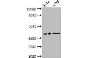 Western Blot Positive WB detected in: Hela whole cell lysate, A375 whole cell lysate All lanes: EDG2 antibody at 1:1000 Secondary Goat polyclonal to rabbit IgG at 1/50000 dilution Predicted band size: 42, 42 kDa Observed band size: 42 kDa (Recombinant LPAR1 antibody)
