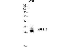 Western Blot (WB) analysis of 293T lysis using MRP-L10 antibody. (MRPL10 antibody  (C-Term))