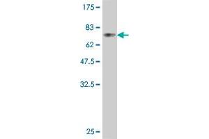 Western Blot detection against Immunogen (78. (SIRPA antibody  (AA 28-507))