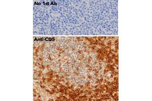 Immunohistochemistry (IHC) image for anti-CD5 (CD5) (AA 105-210) antibody (ABIN7272988) (CD5 antibody  (AA 105-210))