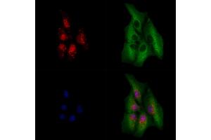 ABIN6264185 and ABIN6279642 staining  cells by IF/ICC.