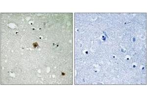 Immunohistochemistry analysis of paraffin-embedded human brain, using TOP2A (Phospho-Ser1525) Antibody. (Topoisomerase II alpha antibody  (pSer1525))