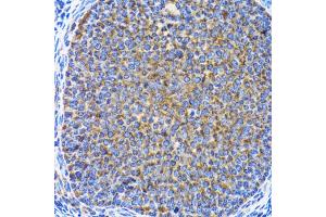 Immunohistochemistry of paraffin-embedded rat ovary using MAP1LC3A antibody.