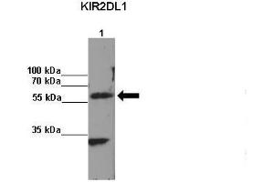 Amount and Sample Type: Lane 1:2x107 KIR2DL1 transfected NKL cells IP Antibody: KIR2DL1 Amount of IP Antibody: Primary Antibody: KIR2DL1 Primary Antibody Dilution: 1: x50Secondary Antibody: Anti-rabbit-HRP Secondary Antibody Dilution: 1:x0,000  Gene Name: KIR2DL1 Submitted by: Kerry S. (KIR2DL1 antibody  (C-Term))