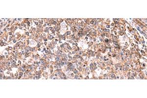 Immunohistochemistry of paraffin-embedded Human tonsil tissue using KBTBD11 Polyclonal Antibody at dilution of 1:35(x200) (KBTBD11 antibody)