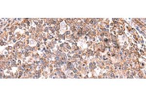 Immunohistochemistry of paraffin-embedded Human tonsil tissue using KBTBD11 Polyclonal Antibody at dilution of 1:35(x200)