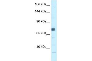 WB Suggested Anti-BRCA1 Antibody Titration: 0. (BRCA1 antibody  (N-Term))