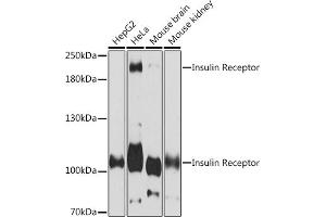 Western blot analysis of extracts of various cell lines, using Insulin Receptor Rabbit pAb (ABIN7267890) at 1:3000 dilution. (Insulin Receptor antibody  (AA 1281-1382))