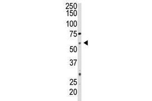 Image no. 1 for anti-5'-Nucleotidase, Ecto (CD73) (NT5E) (C-Term) antibody (ABIN357390)