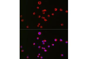 Immunofluorescence analysis of Neuro-2a cells using OPRK1 Rabbit pAb (ABIN6134089, ABIN6145043, ABIN6145045 and ABIN6218249) at dilution of 1:50 (40x lens). (OPRK1 antibody  (C-Term))