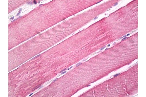 Myosin X antibody  (Internal Region)