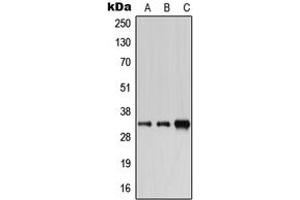 Western blot analysis of Carbonic Anhydrase 6 expression in HEK293T (A), SP2/0 (B), H9C2 (C) whole cell lysates.