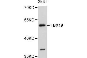 Western blot analysis of extracts of 293T cells, using TBX19 antibody. (T-Box 19 antibody)