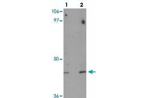 Western blot analysis of DBX1 in mouse kidney tissue with DBX1 polyclonal antibody  at (lane 1) 1 and (lane 2) 2 ug/mL. (DBX1 antibody  (Internal Region))