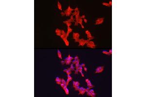 Immunofluorescence (IF) image for anti-Adenylate Cyclase Activating Polypeptide 1 (Pituitary) Receptor Type I (ADCYAP1R1) antibody (ABIN3023490)