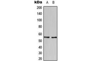 Western blot analysis of HBP1 expression in SKBR3 (A), U937 (B) whole cell lysates. (HBP1 antibody  (C-Term))