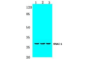 Western blot (WB) analysis of SNAI 1 antibody at 1/500 dilution: (SNAIL antibody)