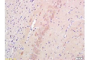 Formalin-fixed and paraffin embedded rat hippocampus labeled with Anti-Nestin Polyclonal Antibody , Unconjugated 1:300 followed by conjugation to the secondary antibody and DAB staining (Nestin antibody  (AA 681-750))