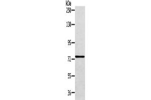 Gel: 6 % SDS-PAGE, Lysate: 40 μg, Lane: A172 cell, Primary antibody: ABIN7131591(VPS53 Antibody) at dilution 1/200 dilution, Secondary antibody: Goat anti rabbit IgG at 1/8000 dilution, Exposure time: 30 seconds