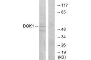 Western blot analysis of extracts from Jurkat cells, using p62 Dok (Ab-362) Antibody.