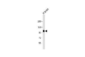 Anti-ADTS17 Antibody (N-term) at 1:2000 dilution + human brain lysate Lysates/proteins at 20 μg per lane. (ADAMTS17 antibody  (N-Term))