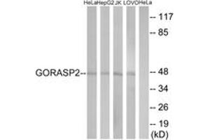Western blot analysis of extracts from HeLa/HepG2/Jurkat/LOVO cells, using GORASP2 Antibody. (GORASP2 antibody  (AA 181-230))