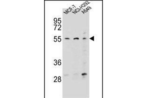 Zinc Finger Protein 117 Antikörper  (N-Term)