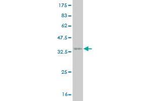 Western Blot detection against Immunogen (36. (UBR4 antibody  (AA 94-190))