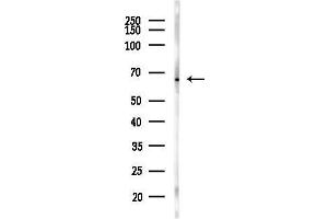anti-Translocase of Outer Mitochondrial Membrane 70 (TOMM70A) (C-Term) antibody