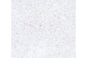 Immunohistochemistry (IHC) image for anti-Cytotoxic T-Lymphocyte-Associated Protein 4 (CTLA4) (C-Term) antibody (ABIN7795649)