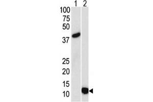 Western blot analysis of SUMO3 antibody and (1) GST-SUMO3 recombinant protein and (2) HL-60 lysate.