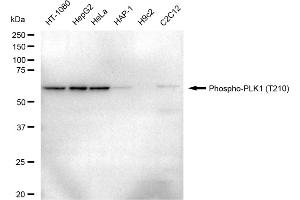 Western blotting analysis using Phospho-PLK1 (T210) antibody (ABIN7799863).