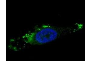 Fluorescent image of chloroquine-treated U251 cells stained with ATG12 antibody. (ATG12 antibody  (AA 1-30))