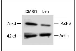Western blot analysis of extracts from  cells, treated with DMSO or lenalidomide, using rabbit polyclonal IKZF3 Antibody (Center) (ABIN651843 and ABIN2840420).