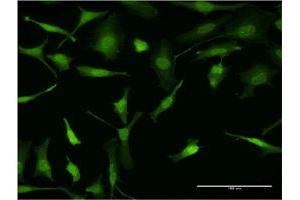 Immunofluorescence of monoclonal antibody to PURA on HeLa cell. (PURA antibody  (AA 183-292))