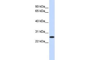 WB Suggested Anti-DULLARD Antibody Titration:  0. (CTDNEP1A antibody  (Middle Region))