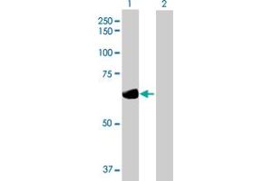 Western Blot analysis of DTNB expression in transfected 293T cell line by DTNB MaxPab polyclonal antibody.