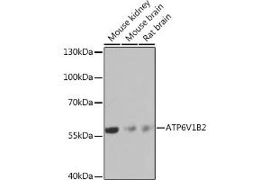 Western blot analysis of extracts of various cell lines, using V1B2 Rabbit pAb  at 1:1000 dilution. (ATP6V1B2 antibody  (AA 262-511))