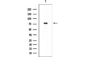 anti-Calpain 5 (CAPN5) antibody