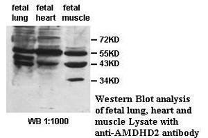 Image no. 1 for anti-Amidohydrolase Domain Containing 2 (AMDHD2) antibody (ABIN1574657) (AMDHD2 antibody)