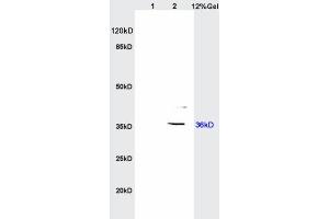 L1 rat brain lysates L2 human colon carcinoma lysates probed with Anti IGFBP2 Polyclonal Antibody, Unconjugated  at 1:200 overnight at 4˚C. (IGFBP2 antibody  (AA 101-200))