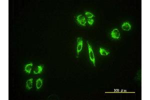 Immunofluorescence of monoclonal antibody to EHD4 on HeLa cell.