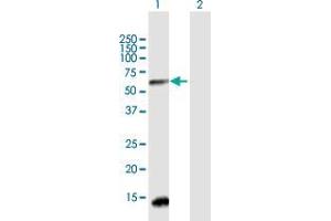 Western Blot analysis of HAVCR1 expression in transfected 293T cell line by HAVCR1 MaxPab polyclonal antibody. (HAVCR1 antibody  (AA 1-364))