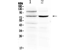 Western blot analysis of Dishevelled 2 using anti- Dishevelled 2 antibody . (DVL2 antibody  (N-Term))