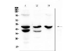 Western blot analysis of Cathepsin E using anti-Cathepsin E antibody (ABIN5692831).
