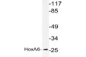 Western blot (WB) analysis of HoxA6 antibody in extracts from K562 cells.